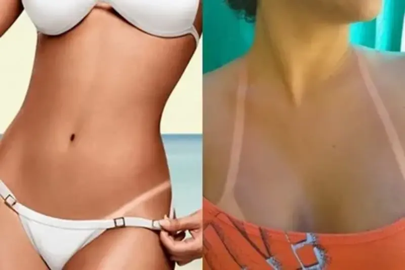 Bronzeamento artificial antes e depois