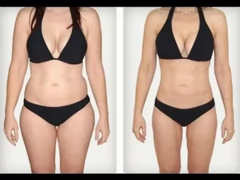 Enzimas de emagrecimento antes e depois
